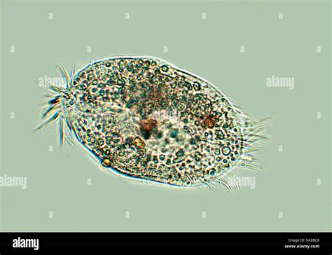  Rhytidia: A Glimpse into the Microscopic World of this Stunning Ciliate!